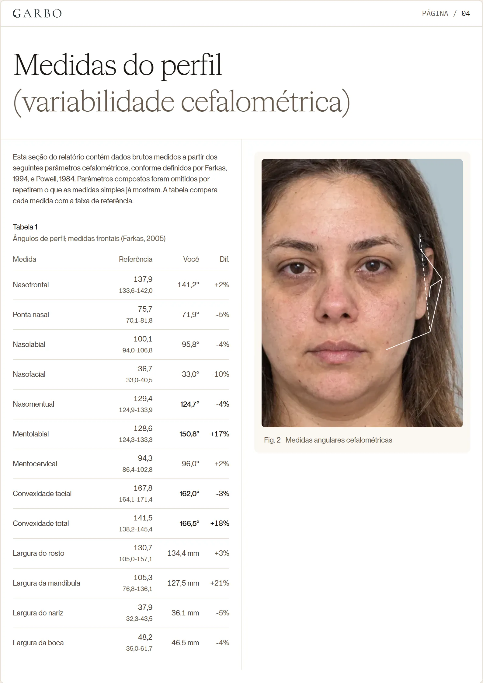 Página do Relatório cirúrgico, com as proporções do rosto marcadas na foto