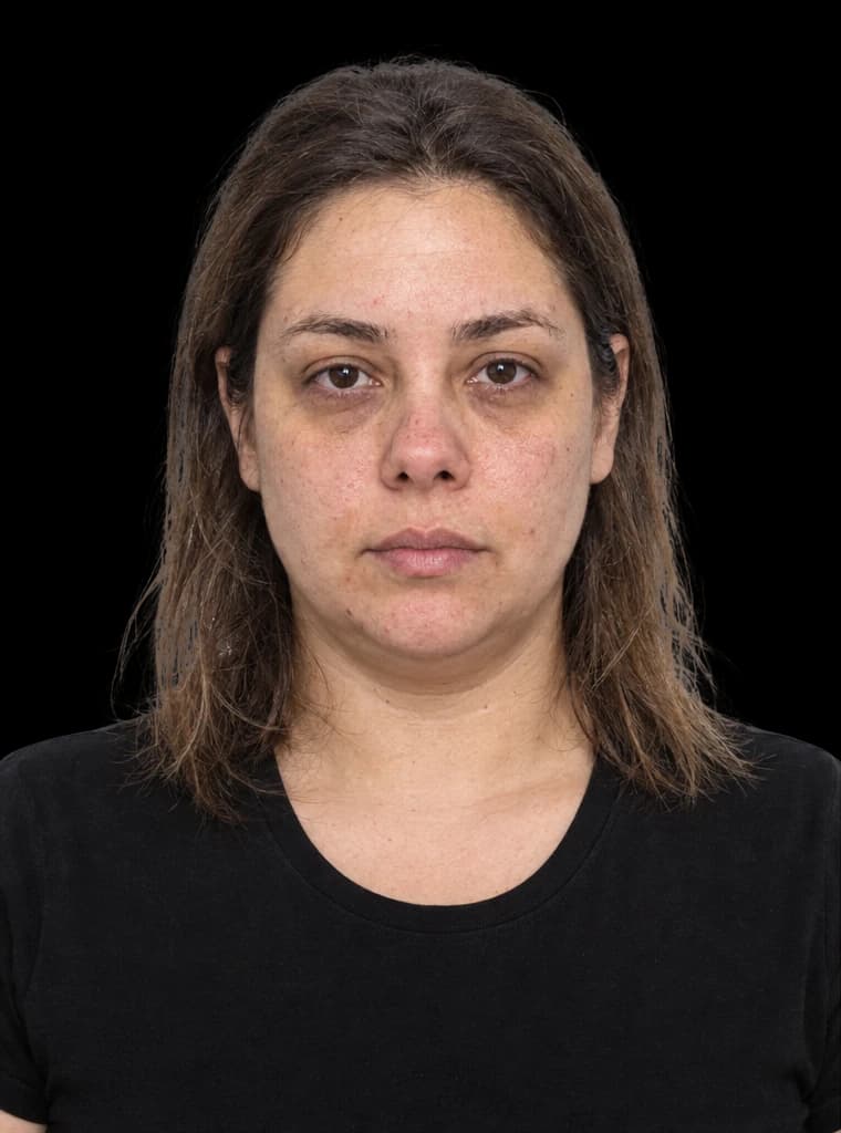 Mulher de uns 35 anos, de camiseta preta, com cabelo ressecado, sem maquiagem, olheiras e expressão cansada.